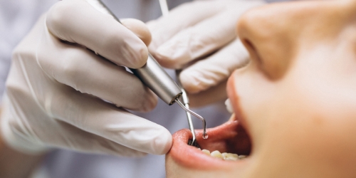 Как стресс влияет на здоровье зубов? Рассказывает стоматолог
